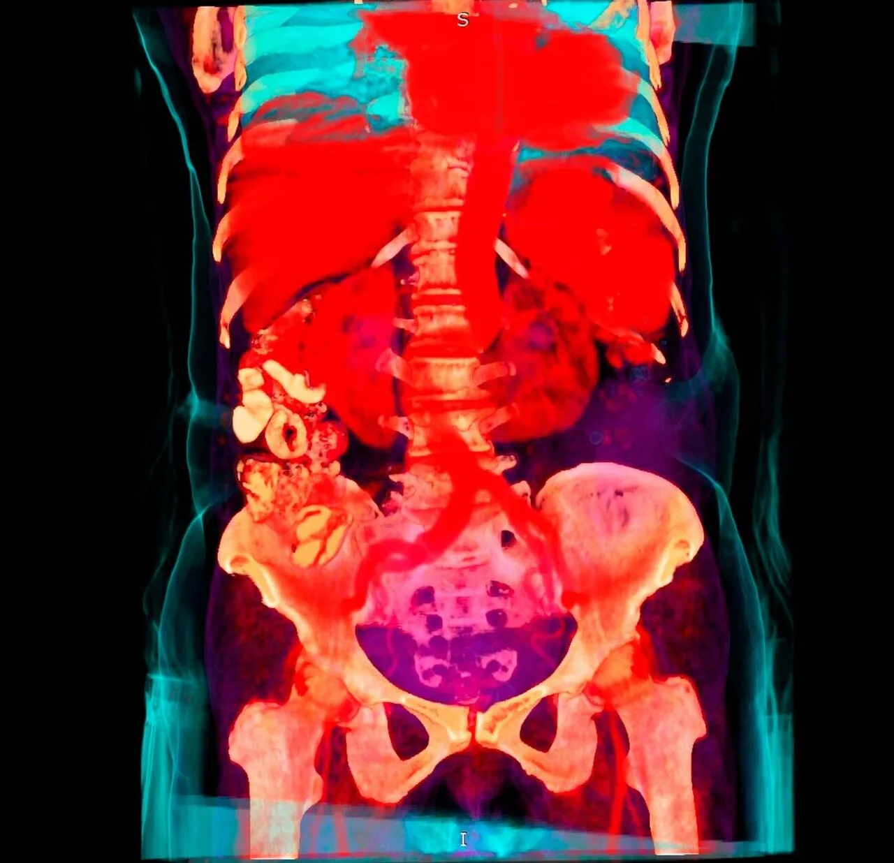Abdomen