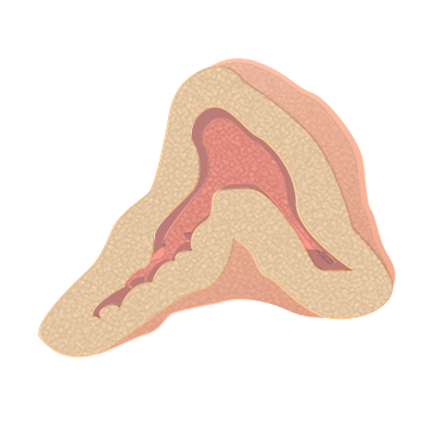 Adrenal gland