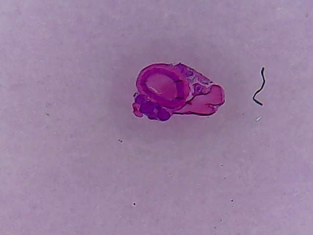 Artery