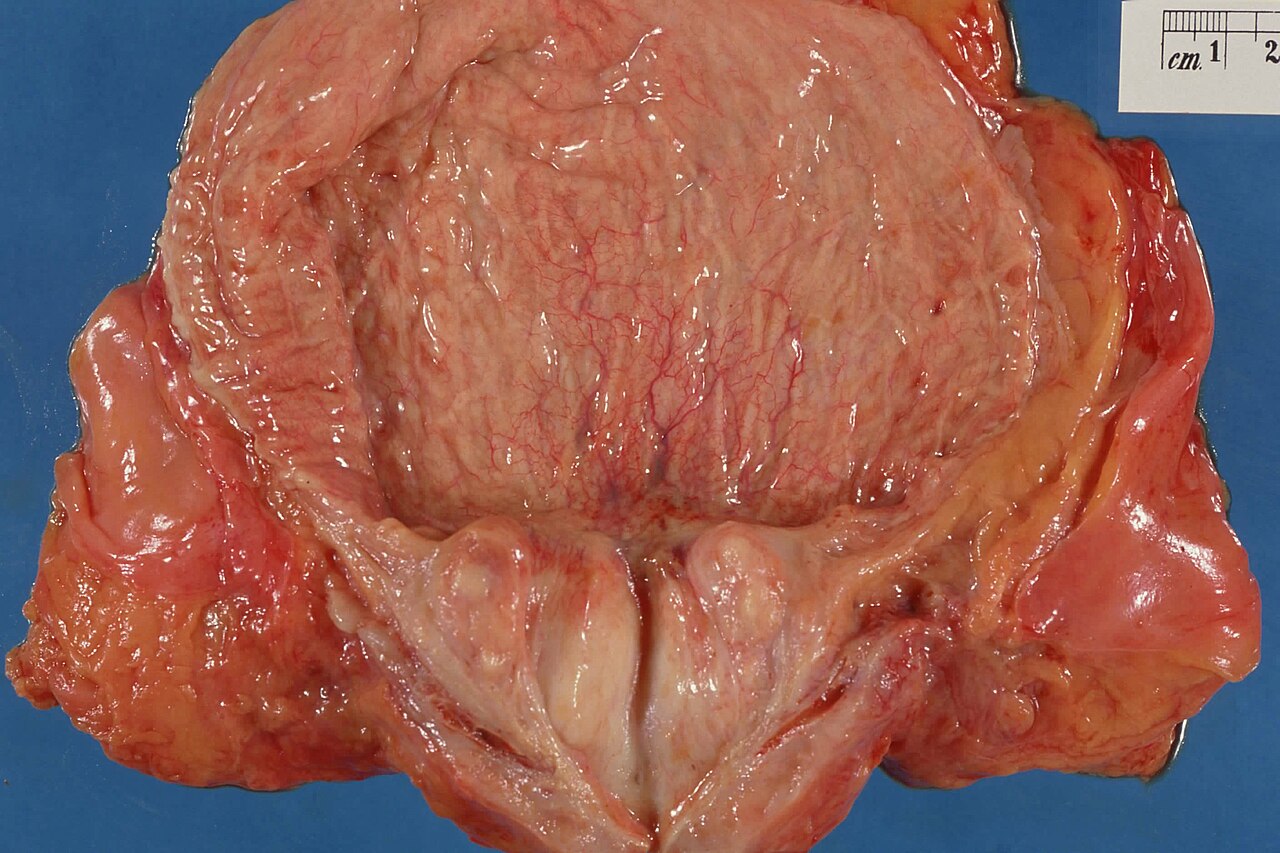Bladder