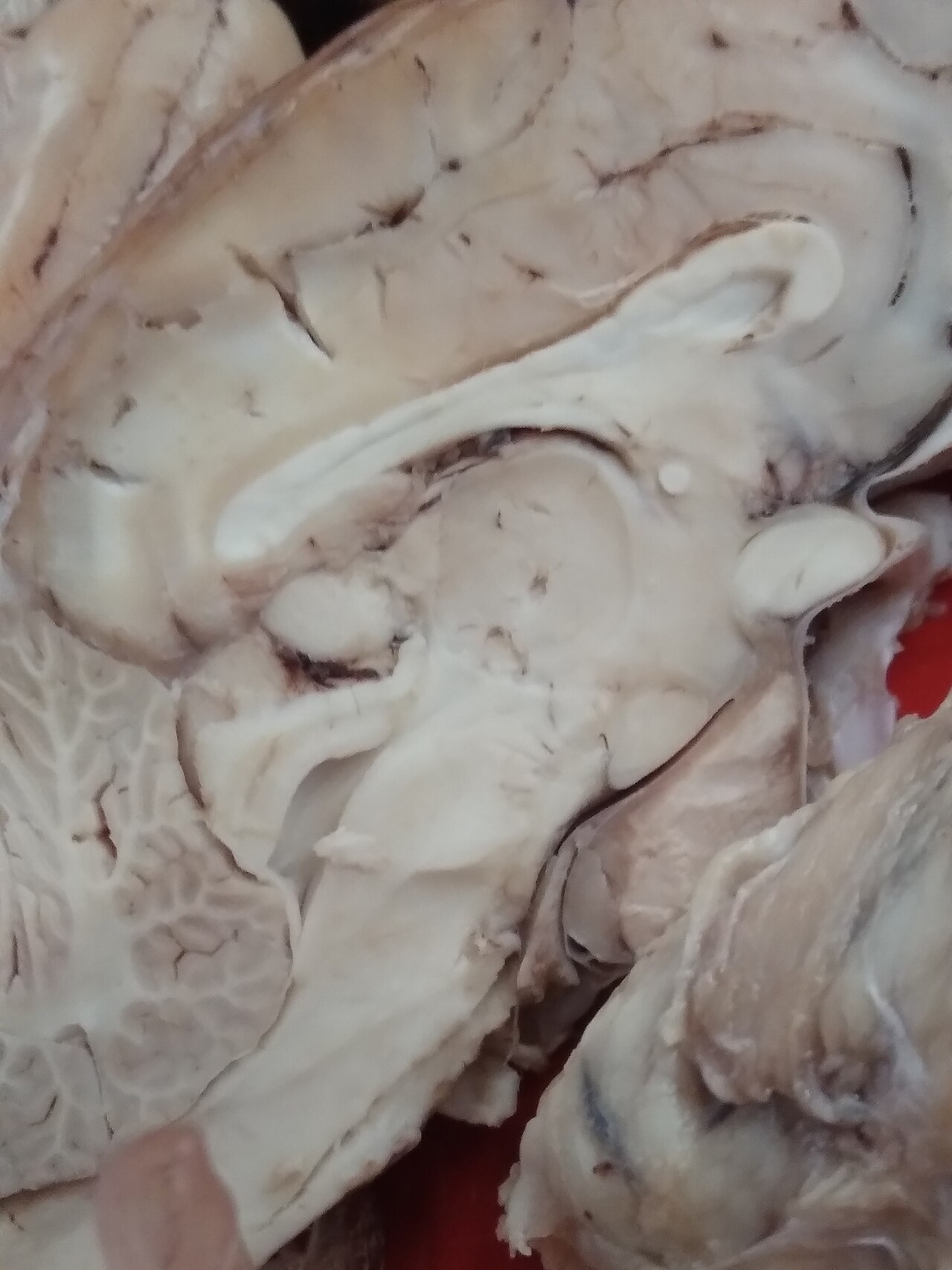Brain