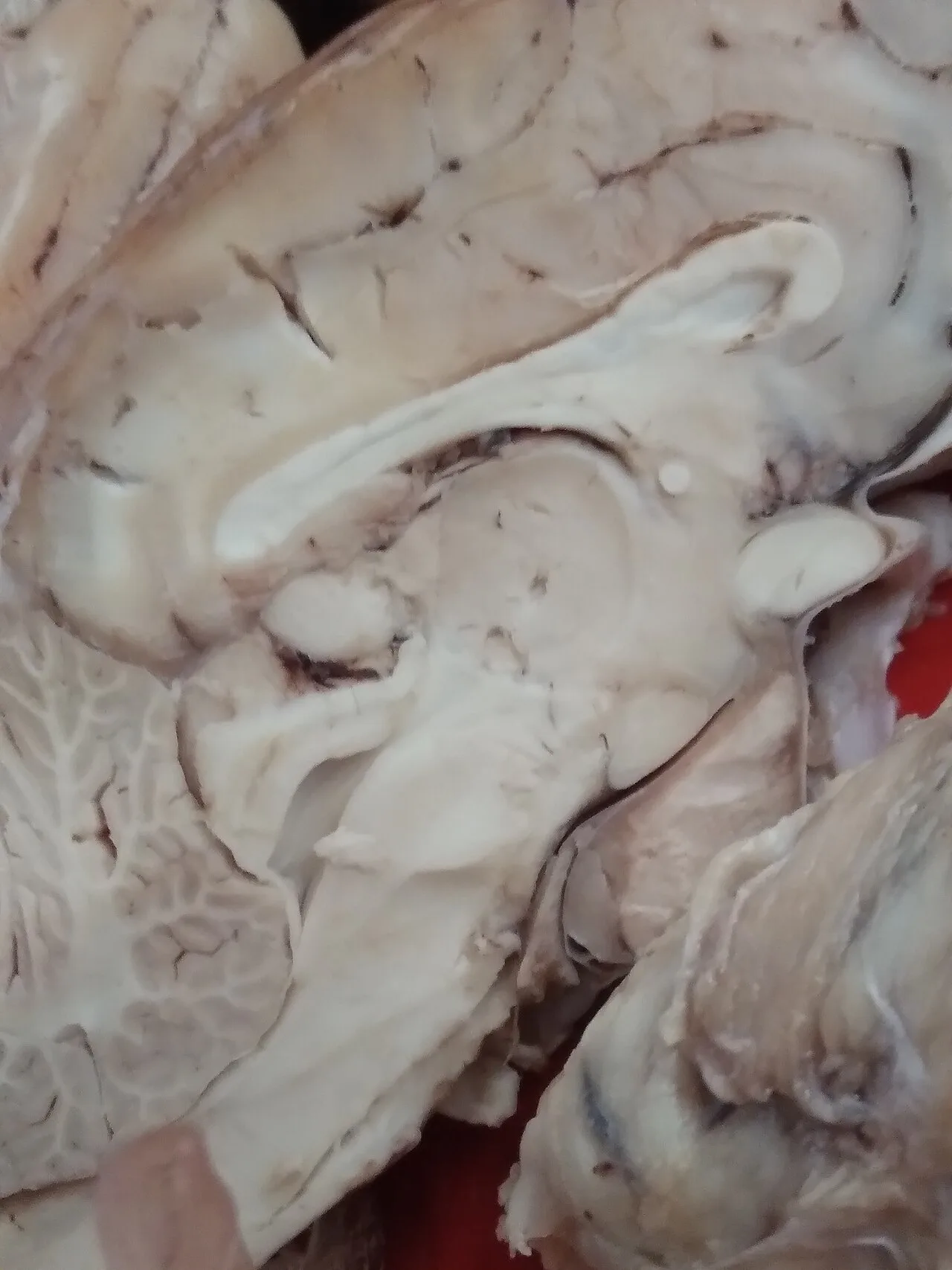 Brain