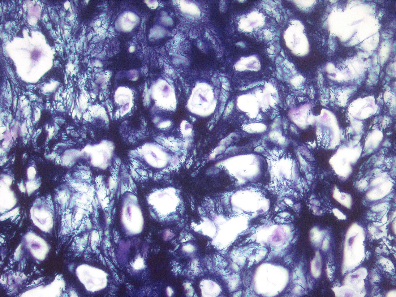 Cartilage