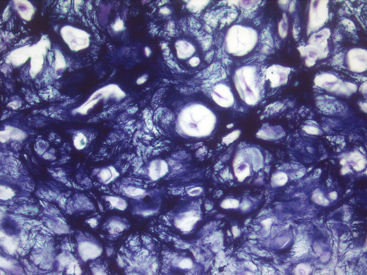Cartilage
