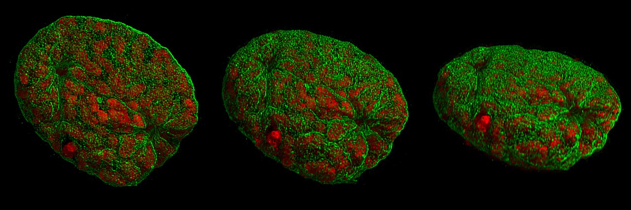 Cell nucleus